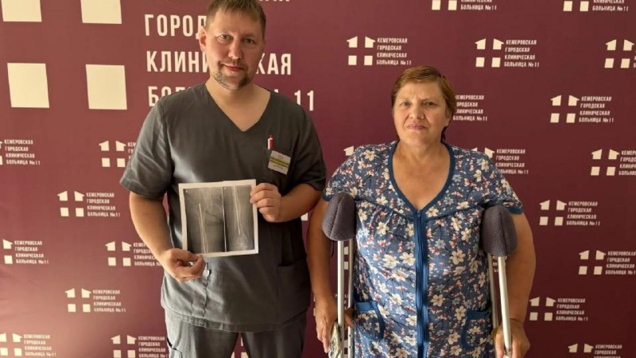 В Кемерове врачи удалили штифт из бедренной кости пациентки спустя 44 года — Кемерово Сейчас